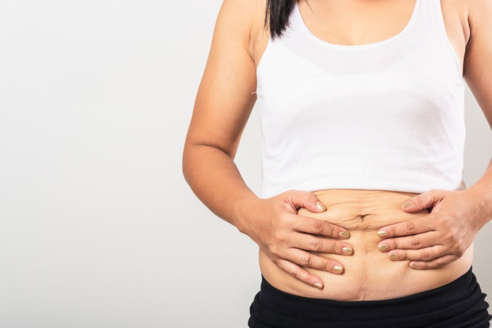 Transform Your Body: How To Effectively Remove Loose Skin After Weight Loss