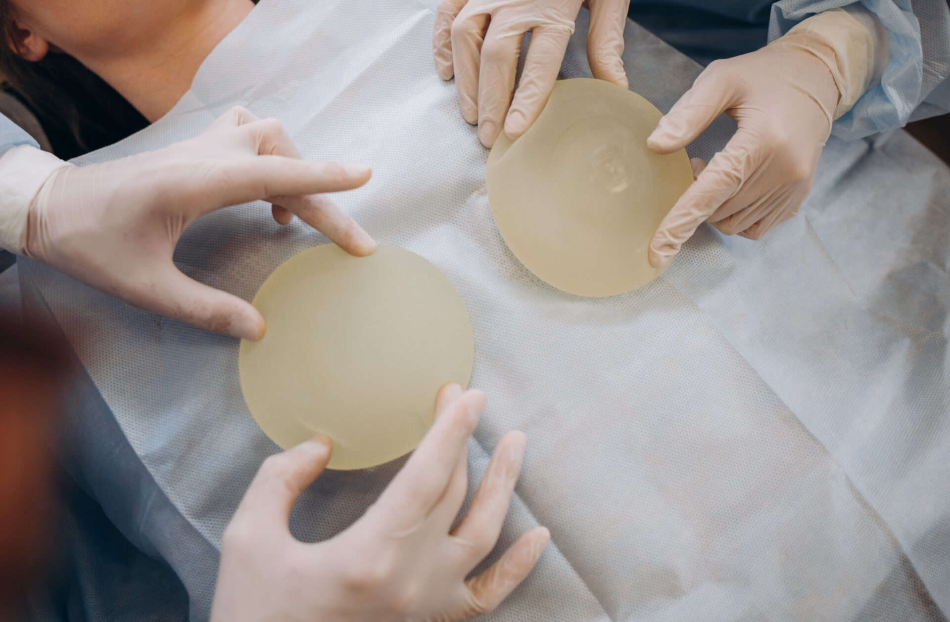 How Long Will My Breast Implants Last and What Changes Can I Expect Over Time?