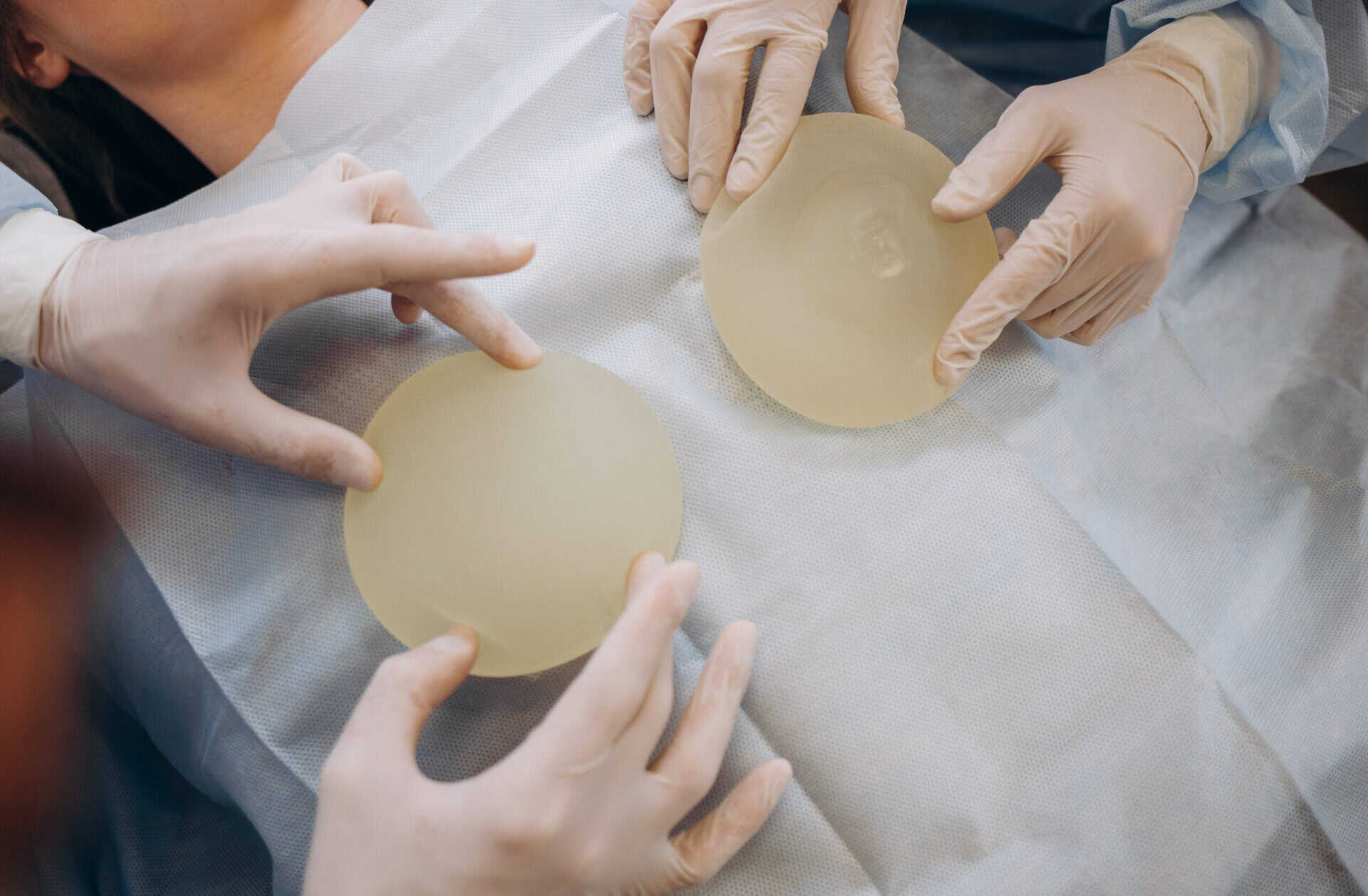How Long Will My Breast Implants Last and What Changes Can I Expect Over Time?
