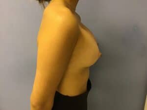 Patient_Image 03_21_23 09_27_42 (2)