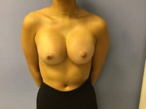 Patient_Image 03_21_23 09_27_42 (3)