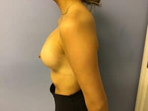 Patient_Image 03_21_23 09_27_42 (4)