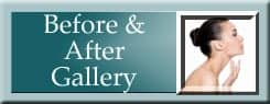 Before & After Gallery